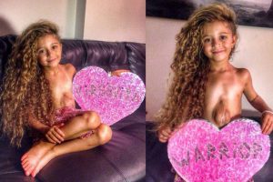 छाति बाहिर मुटु भएकी बालिका