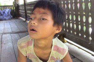 पशु झैँ दाम्लोमा ६ बर्षीय बालक