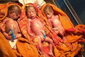 एक महिलाले एकै पल्ट जन्माइन तीनवटा बच्चा